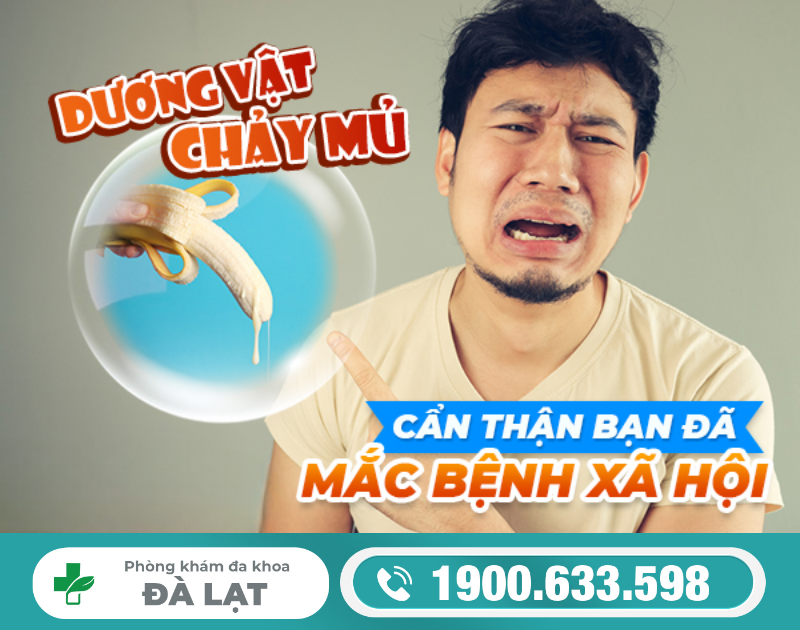 Hình ảnh minh họa